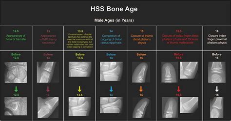 dating bones age